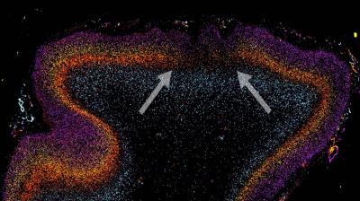 UCSDBrain